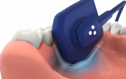Vatech showcases a new intraoral  sensor in North America and Europe