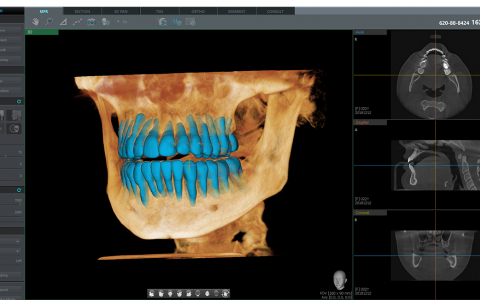 이우소프트, 3D 치아 분리 AI기술 특허-식약처 허가 취득